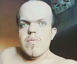 oscarmlg